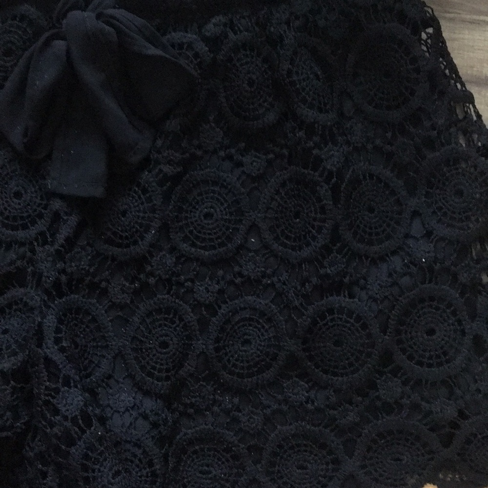 Black patterned shorts - Picture 2 of 3